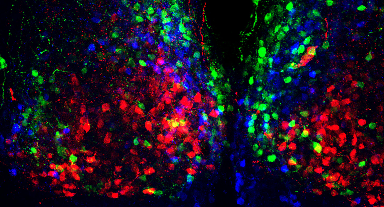 Neurons in the hypothalamus responsible for regulating the body's circadian rhythms.